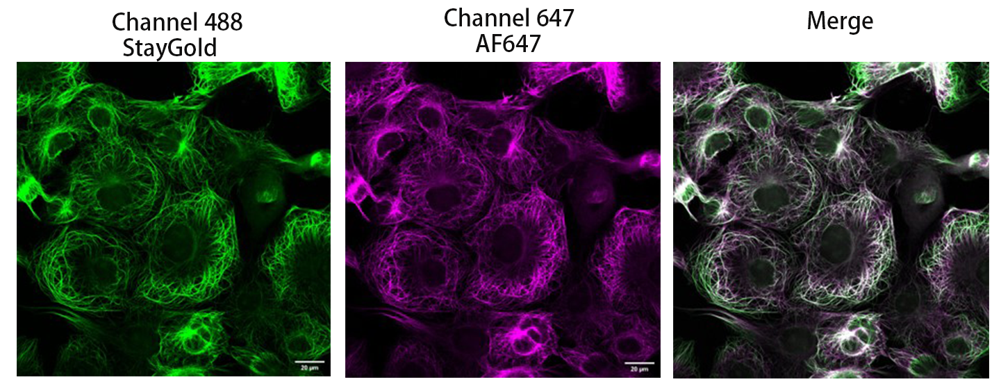 Confocal experiment of StayGold-Ensconsin transfected COS-7 using Anti-StayGold/mBaojin, AlpHcAbs® Rabbit antibody