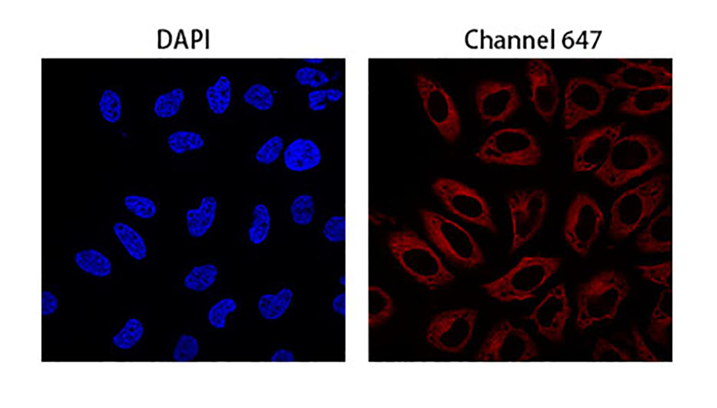 IF experiment of Hela using Anti-Mouse IgG(H+L), AlpSdAbs® VHH(iFluor647 ×8)