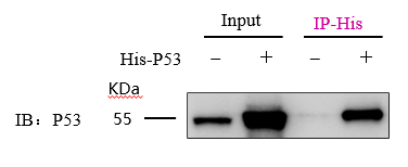 Immunoprecipitation-His tag Nanoselector Magnetic beads
